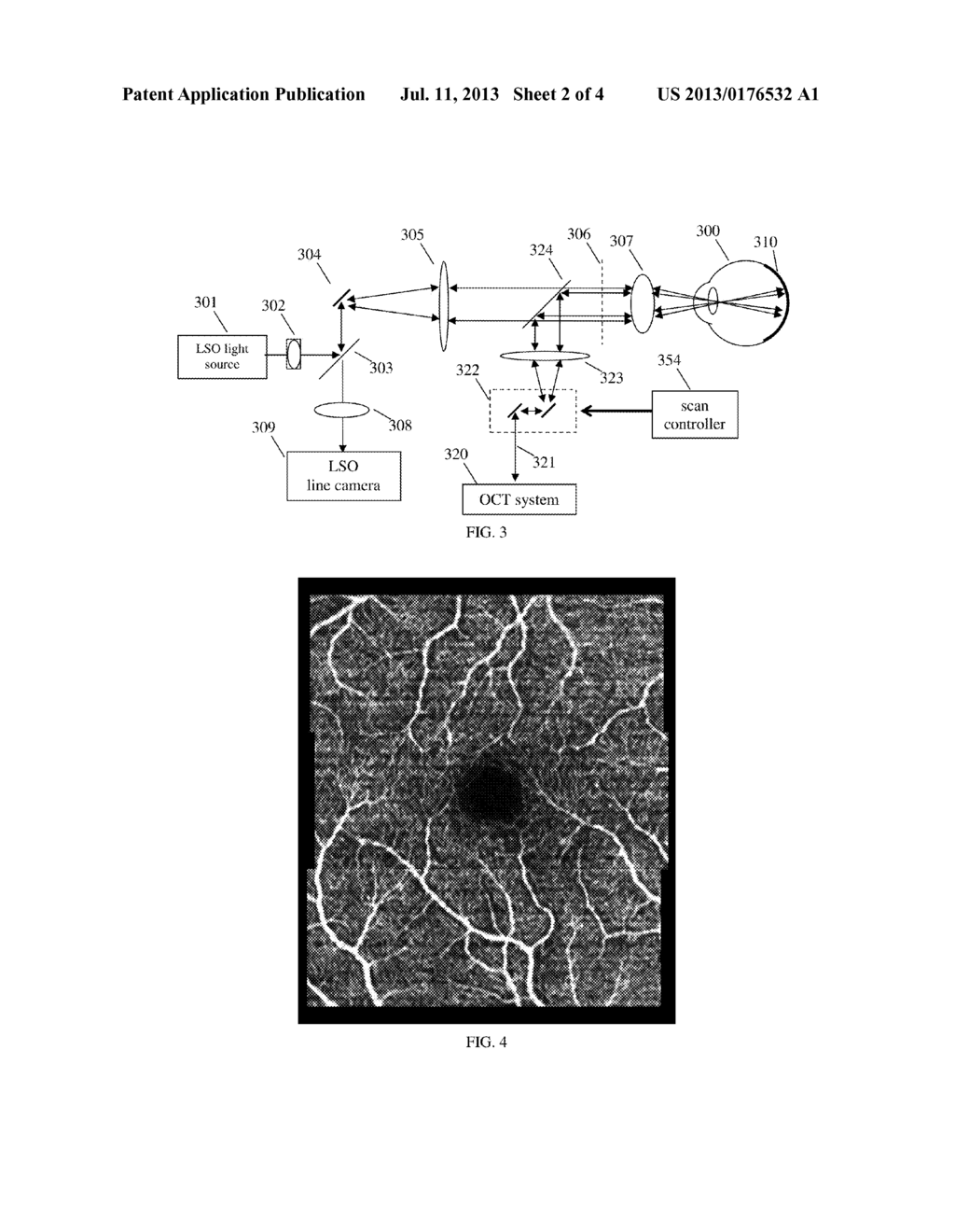 DATA ACQUISITION METHODS FOR REDUCED MOTION ARTIFACTS AND APPLICATIONS IN     OCT ANGIOGRAPHY - diagram, schematic, and image 03