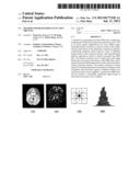 METHOD FOR REGISTERING FUNCTION MRI DATA diagram and image