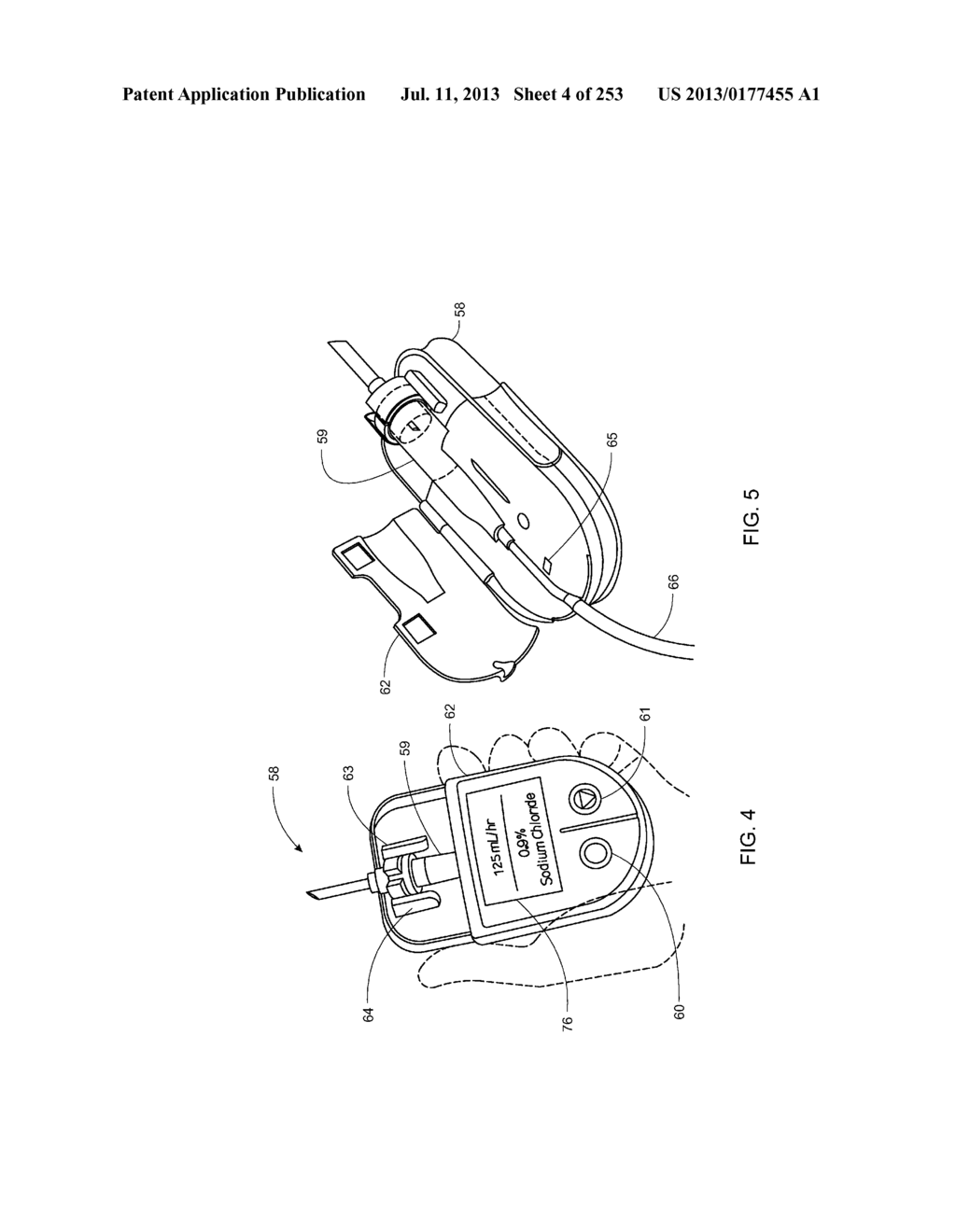 System, Method, and Apparatus for Infusing Fluid - diagram, schematic, and image 05