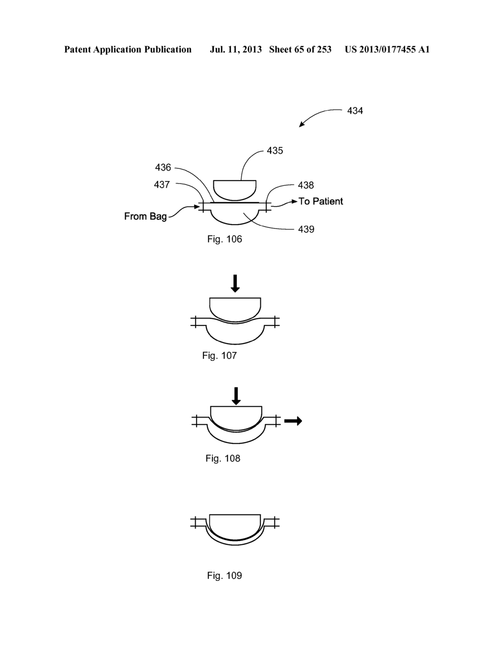 System, Method, and Apparatus for Infusing Fluid - diagram, schematic, and image 66