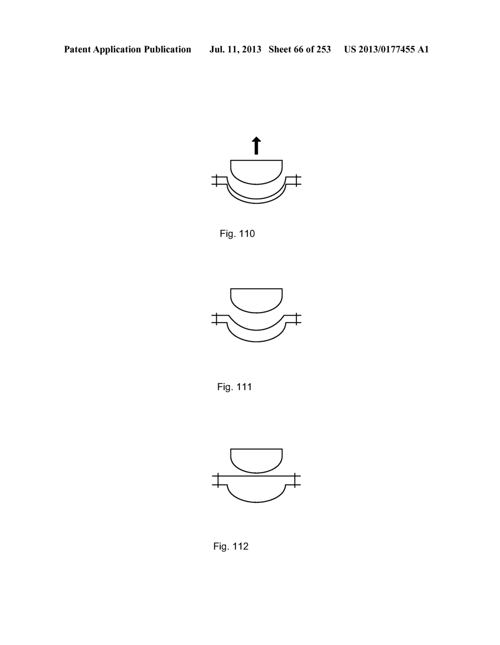 System, Method, and Apparatus for Infusing Fluid - diagram, schematic, and image 67