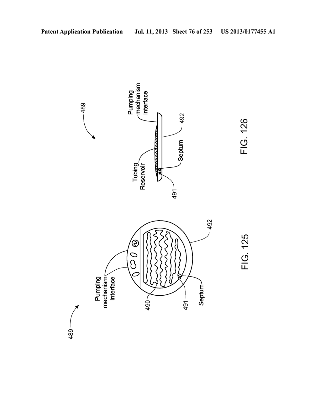 System, Method, and Apparatus for Infusing Fluid - diagram, schematic, and image 77