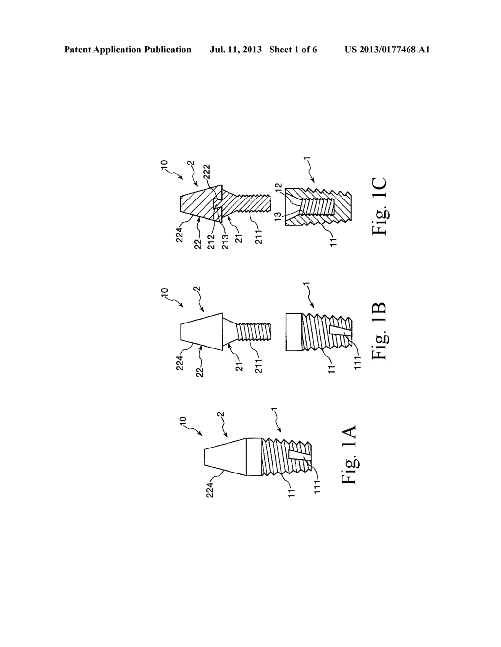 Method for Manufacturing Dental Implant and Dental Implant - diagram, schematic, and image 02