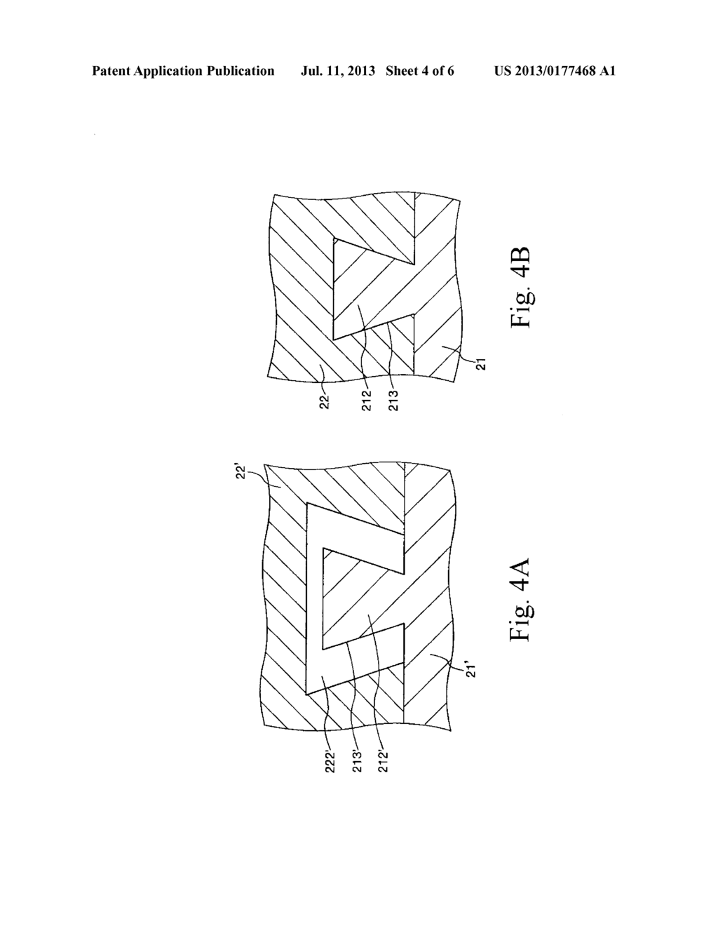 Method for Manufacturing Dental Implant and Dental Implant - diagram, schematic, and image 05