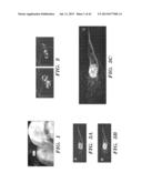 ANTI-DESPR INHIBITORS AS THERAPEUTICS FOR INHIBITION OF PATHOLOGICAL     ANGIOGENESIS AND TUMOR CELL INVASIVENESS AND FOR MOLECULAR IMAGING AND     TARGETED DELIVERY diagram and image