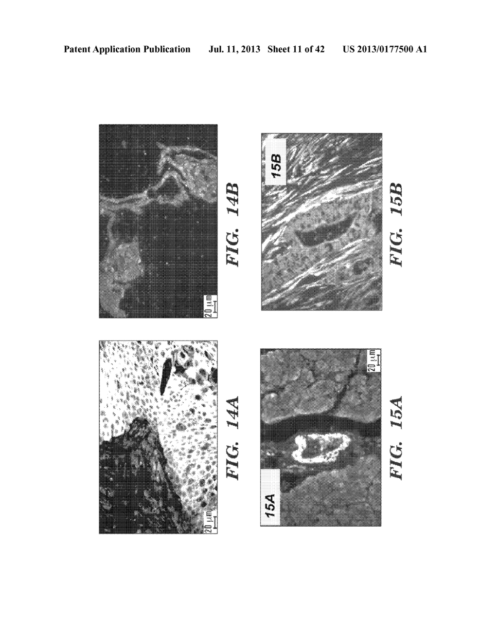 ANTI-DESPR INHIBITORS AS THERAPEUTICS FOR INHIBITION OF PATHOLOGICAL     ANGIOGENESIS AND TUMOR CELL INVASIVENESS AND FOR MOLECULAR IMAGING AND     TARGETED DELIVERY - diagram, schematic, and image 12