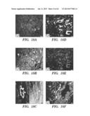 ANTI-DESPR INHIBITORS AS THERAPEUTICS FOR INHIBITION OF PATHOLOGICAL     ANGIOGENESIS AND TUMOR CELL INVASIVENESS AND FOR MOLECULAR IMAGING AND     TARGETED DELIVERY diagram and image