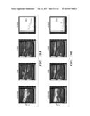 ANTI-DESPR INHIBITORS AS THERAPEUTICS FOR INHIBITION OF PATHOLOGICAL     ANGIOGENESIS AND TUMOR CELL INVASIVENESS AND FOR MOLECULAR IMAGING AND     TARGETED DELIVERY diagram and image