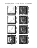 ANTI-DESPR INHIBITORS AS THERAPEUTICS FOR INHIBITION OF PATHOLOGICAL     ANGIOGENESIS AND TUMOR CELL INVASIVENESS AND FOR MOLECULAR IMAGING AND     TARGETED DELIVERY diagram and image