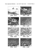 ANTI-DESPR INHIBITORS AS THERAPEUTICS FOR INHIBITION OF PATHOLOGICAL     ANGIOGENESIS AND TUMOR CELL INVASIVENESS AND FOR MOLECULAR IMAGING AND     TARGETED DELIVERY diagram and image