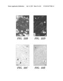 ANTI-DESPR INHIBITORS AS THERAPEUTICS FOR INHIBITION OF PATHOLOGICAL     ANGIOGENESIS AND TUMOR CELL INVASIVENESS AND FOR MOLECULAR IMAGING AND     TARGETED DELIVERY diagram and image