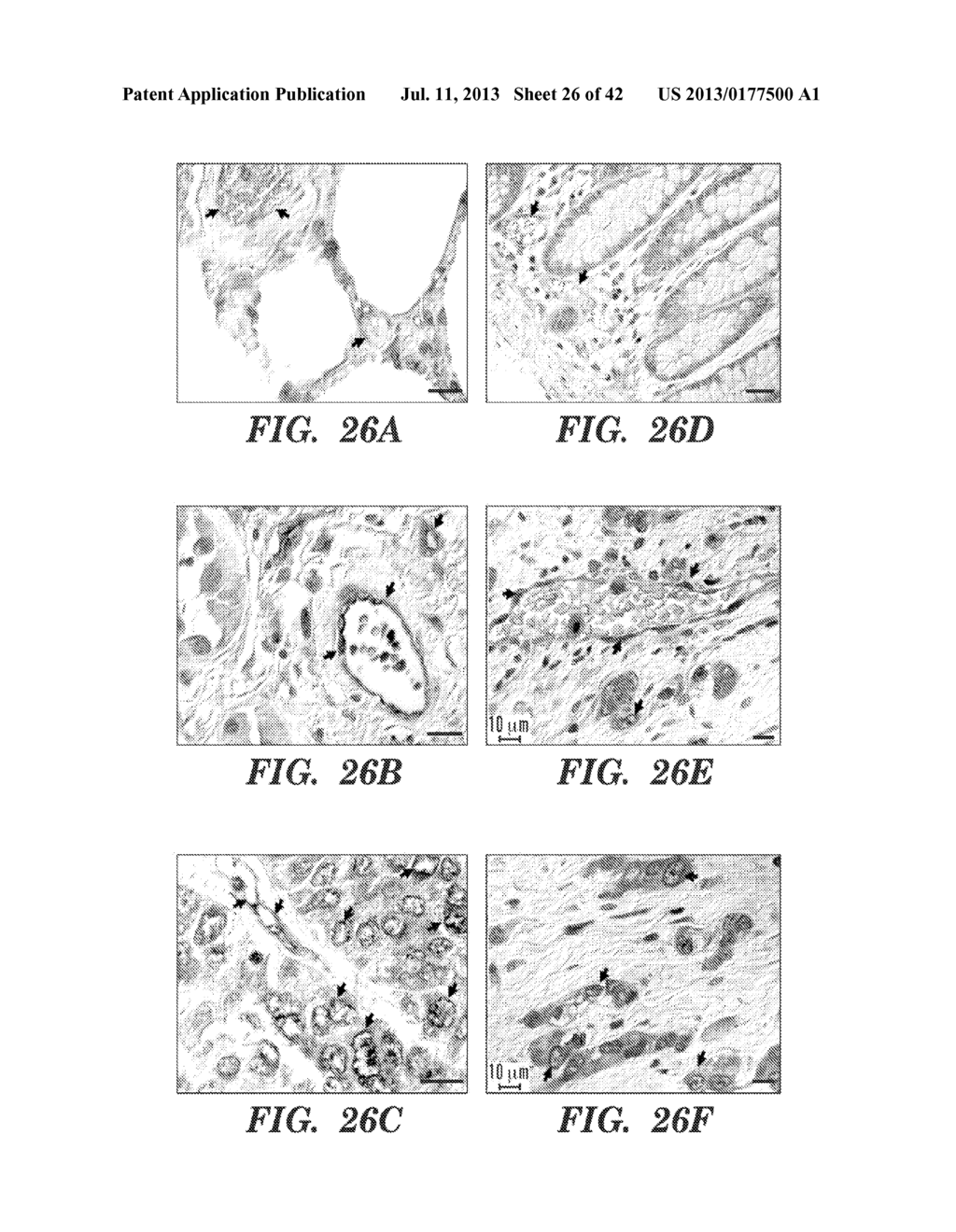 ANTI-DESPR INHIBITORS AS THERAPEUTICS FOR INHIBITION OF PATHOLOGICAL     ANGIOGENESIS AND TUMOR CELL INVASIVENESS AND FOR MOLECULAR IMAGING AND     TARGETED DELIVERY - diagram, schematic, and image 27