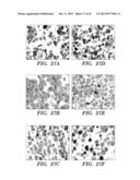 ANTI-DESPR INHIBITORS AS THERAPEUTICS FOR INHIBITION OF PATHOLOGICAL     ANGIOGENESIS AND TUMOR CELL INVASIVENESS AND FOR MOLECULAR IMAGING AND     TARGETED DELIVERY diagram and image