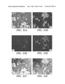 ANTI-DESPR INHIBITORS AS THERAPEUTICS FOR INHIBITION OF PATHOLOGICAL     ANGIOGENESIS AND TUMOR CELL INVASIVENESS AND FOR MOLECULAR IMAGING AND     TARGETED DELIVERY diagram and image