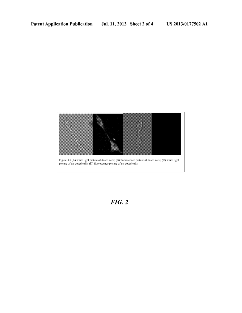 Targeted, NIR Imaging Agents for Therapy Efficacy Monitoring, Deep Tissue     Disease Demarcation and Deep Tissue Imaging - diagram, schematic, and image 03