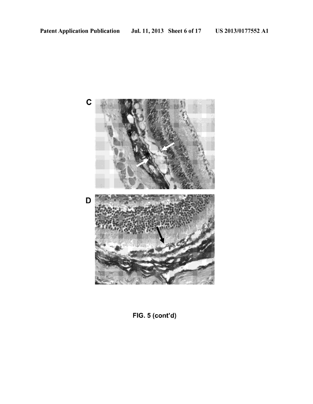 METHODS AND COMPOSITIONS FOR MODULATING OCULAR DAMAGE - diagram, schematic, and image 07