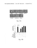 NOVEL THERAPEUTIC TARGET AND DIAGNOSTIC MARKER FOR ASTHMA AND RELATED     CONDITIONS diagram and image