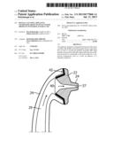 DENTAL CLEANING APPLIANCE GENERATING HIGH VELOCITY WATER DROPLETS WITH     REPLACEMENT TIP diagram and image