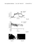 ENDODONTIC FILES AND METHOD OF PREPARATION THEREOF diagram and image