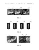 SYSTEMS AND METHODS FOR RECORDING DENTAL-IMPLANT INFORMATION diagram and image