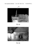 SYSTEMS AND METHODS FOR RECORDING DENTAL-IMPLANT INFORMATION diagram and image