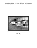 SYSTEMS AND METHODS FOR RECORDING DENTAL-IMPLANT INFORMATION diagram and image