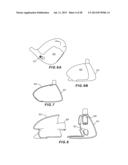 GOLF CLUB HEAD WITH SEPARABLE COMPONENT diagram and image