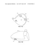 GOLF CLUB HEAD WITH SEPARABLE COMPONENT diagram and image