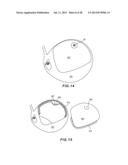 GOLF CLUB HEAD WITH SEPARABLE COMPONENT diagram and image