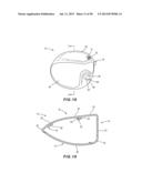 GOLF CLUB HEAD WITH SEPARABLE COMPONENT diagram and image