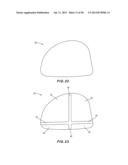 GOLF CLUB HEAD WITH SEPARABLE COMPONENT diagram and image