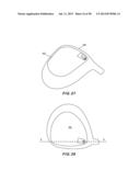 GOLF CLUB HEAD WITH SEPARABLE COMPONENT diagram and image