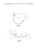 GOLF CLUB HEAD WITH SEPARABLE COMPONENT diagram and image