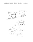 GOLF CLUB HEAD WITH SEPARABLE COMPONENT diagram and image