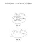 GOLF CLUB HEAD WITH SEPARABLE COMPONENT diagram and image