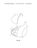 GOLF CLUB HEAD WITH SEPARABLE COMPONENT diagram and image