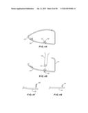 GOLF CLUB HEAD WITH SEPARABLE COMPONENT diagram and image