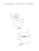 GOLF CLUB HEAD WITH SEPARABLE COMPONENT diagram and image