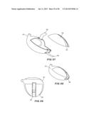 GOLF CLUB HEAD WITH SEPARABLE COMPONENT diagram and image