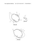 GOLF CLUB HEAD WITH SEPARABLE COMPONENT diagram and image