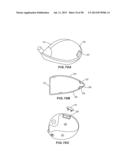 GOLF CLUB HEAD WITH SEPARABLE COMPONENT diagram and image