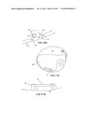 GOLF CLUB HEAD WITH SEPARABLE COMPONENT diagram and image