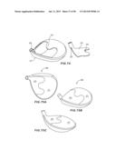 GOLF CLUB HEAD WITH SEPARABLE COMPONENT diagram and image