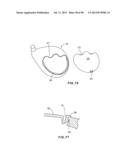 GOLF CLUB HEAD WITH SEPARABLE COMPONENT diagram and image