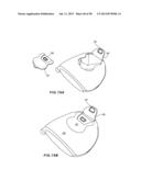 GOLF CLUB HEAD WITH SEPARABLE COMPONENT diagram and image