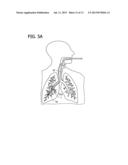 THERAPEUTIC AGENT FOR PULMONARY EMPHYSEMA diagram and image