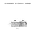 COMPOSITIONS AND METHODS FOR TREATING SKIN CANCER ASSOCIATED DISEASES diagram and image