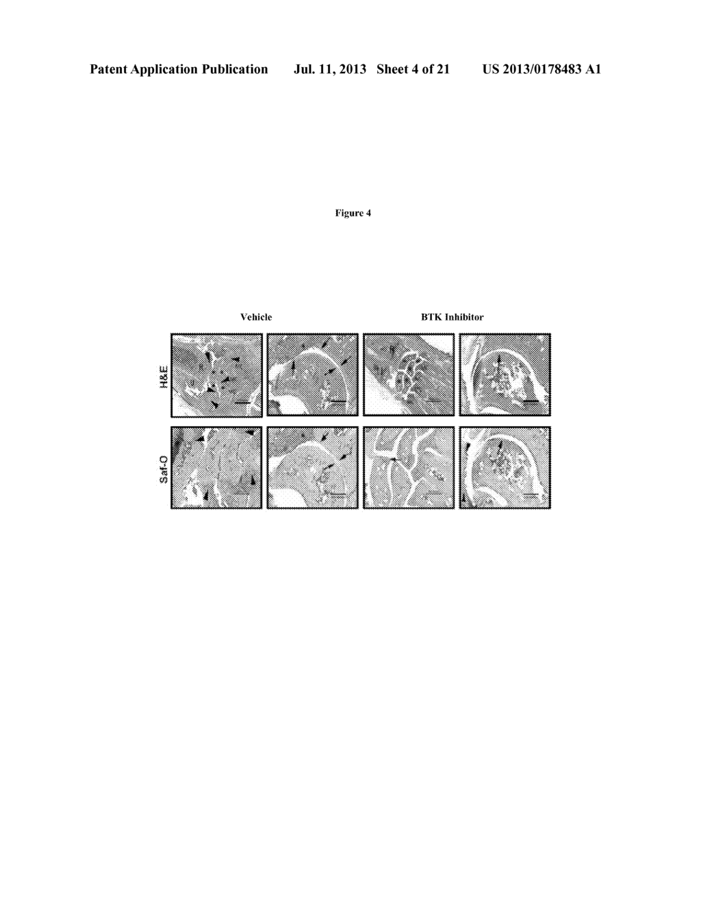 Methods and Compositions for Inhibition of Bone Resorption - diagram, schematic, and image 05