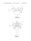 BODILY IMPLANTS FORMED FROM DIFFERENT MATERIALS diagram and image