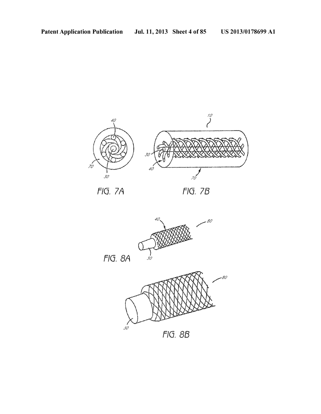 MINIMALLY INVASIVE TISSUE SUPPORT - diagram, schematic, and image 05